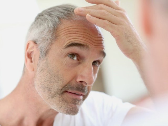 Почему выпадают волосы у мужчин и что с этим делать? Первые признаки облысения у мужчин — как распознать? Как восстановить волосы мужчине при облысении?